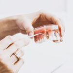 Revolutionizing Smiles: Same Day Dental Implants