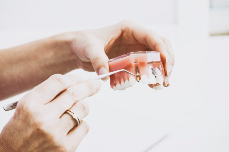 Revolutionizing Smiles: Same Day Dental Implants